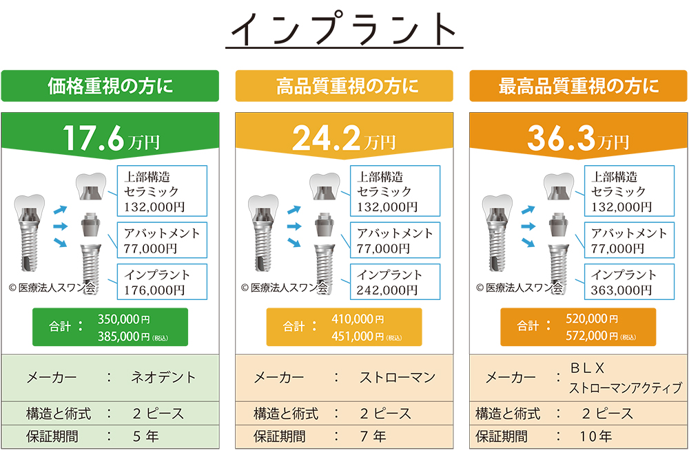 インプラント価格表